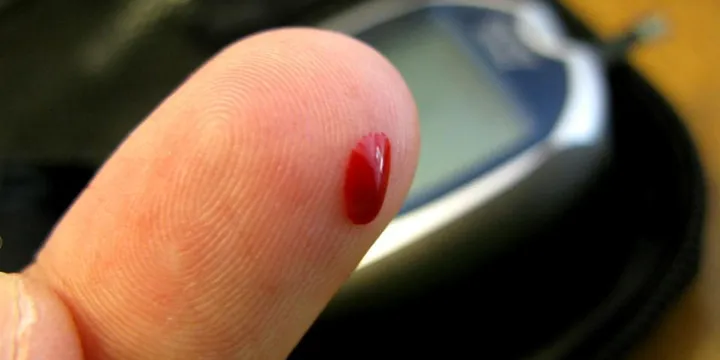 Levels CGM Review: Is a Continuous Glucose Monitor Worth It for Non-Diabetics? (2026)